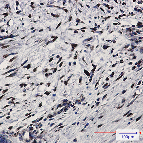 PKR Rabbit Monoclonal Antibody | 兔单抗 | EnkiLife恩玑生命