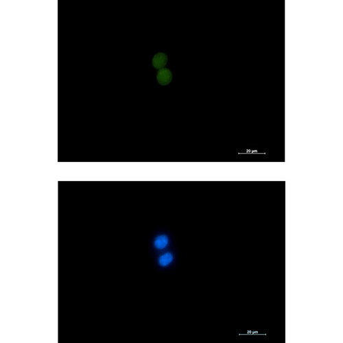 ASH2L Rabbit Monoclonal Antibody | 兔单抗 | EnkiLife恩玑生命