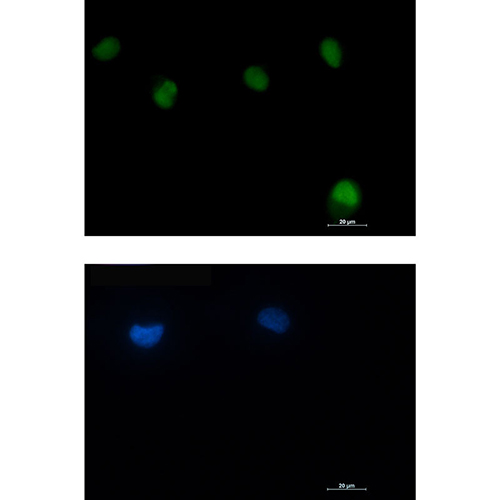 ATM Rabbit Monoclonal Antibody | 兔单抗 | EnkiLife恩玑生命
