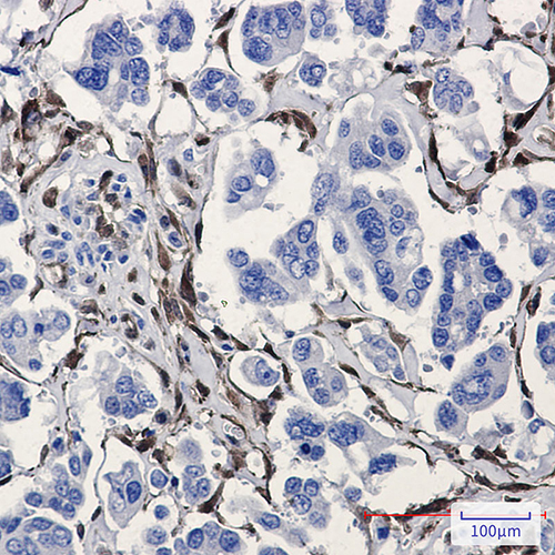 ALDH1A1 Rabbit Monoclonal Antibody | 兔单抗 | EnkiLife恩玑生命