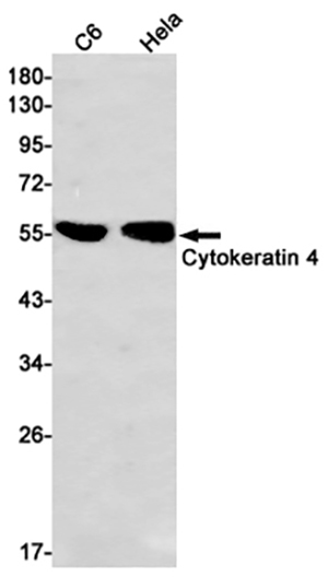 Cytokeratin 4 Rabbit Monoclonal Antibody | 兔单抗 | EnkiLife恩玑生命