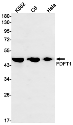 FDFT1 Rabbit Monoclonal Antibody | 兔单抗 | EnkiLife恩玑生命