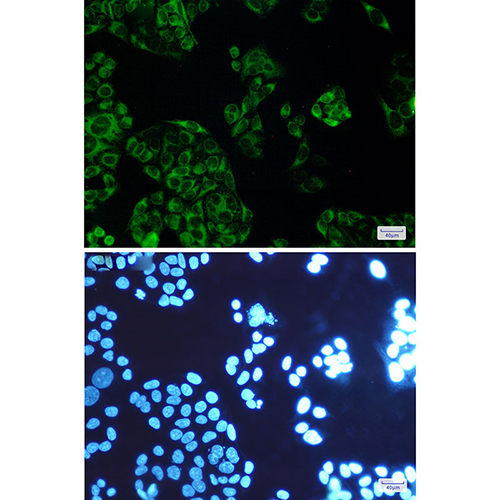 FDFT1 Rabbit Monoclonal Antibody | 兔单抗 | EnkiLife恩玑生命