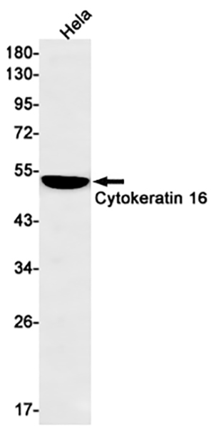 Cytokeratin 16 Rabbit Monoclonal Antibody | 兔单抗 | EnkiLife恩玑生命