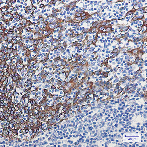 Cytokeratin 16 Rabbit Monoclonal Antibody | 兔单抗 | EnkiLife恩玑生命