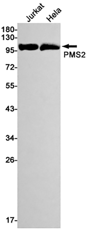 PMS2 Rabbit Monoclonal Antibody | 兔单抗 | EnkiLife恩玑生命
