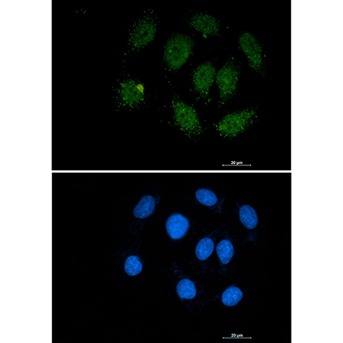 Smad3 Rabbit Monoclonal Antibody | 兔单抗 | EnkiLife恩玑生命