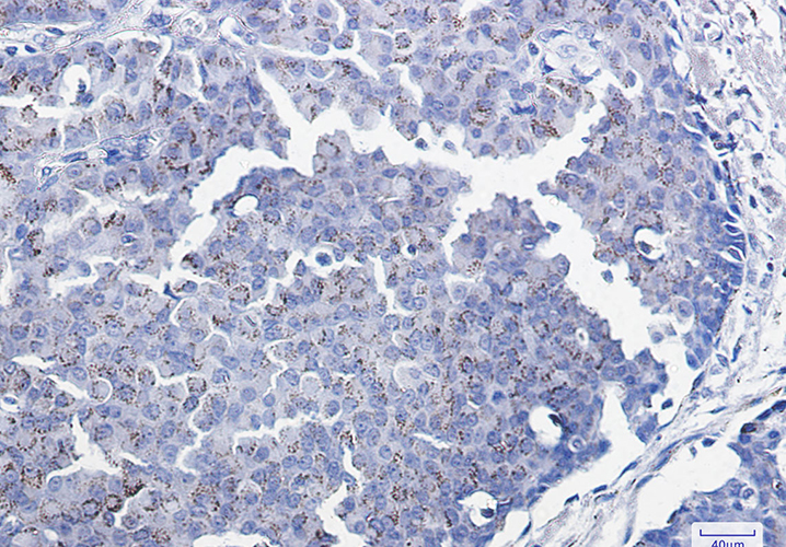 Smad3 Rabbit Monoclonal Antibody | 兔单抗 | EnkiLife恩玑生命