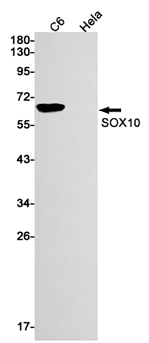 SOX10 Rabbit Monoclonal Antibody | 兔单抗 | EnkiLife恩玑生命
