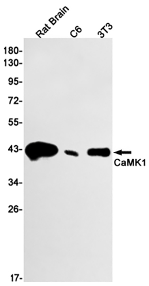 CaMK1 Rabbit Monoclonal Antibody | 兔单抗 | EnkiLife恩玑生命