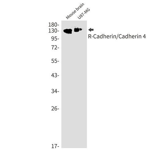 R Cadherin Rabbit Monoclonal Antibody | 兔单抗 | EnkiLife恩玑生命