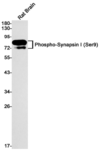 Phospho-Synapsin I (Ser9) Rabbit Monoclonal Antibody | 兔单抗 | EnkiLife恩玑生命