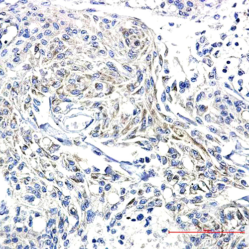Phospho-Synapsin I (Ser9) Rabbit Monoclonal Antibody | 兔单抗 | EnkiLife恩玑生命