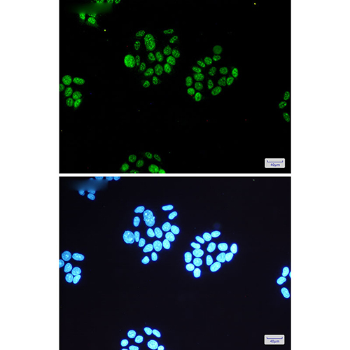 Phospho-MSK1 (Ser360) Rabbit Monoclonal Antibody | 兔单抗 | EnkiLife恩玑生命