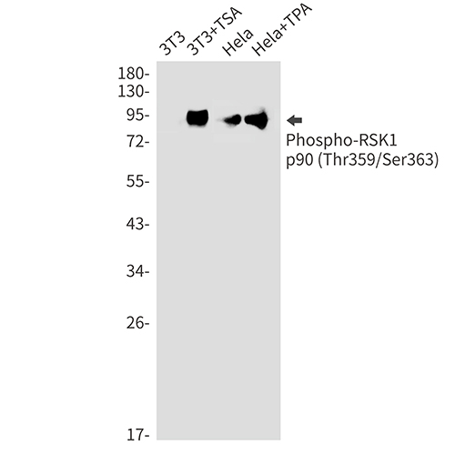 Phospho-RSK1 p90 (Thr359/Ser363) Rabbit Monoclonal Antibody | 兔单抗 | EnkiLife恩玑生命
