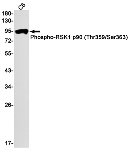 Phospho-RSK1 p90 (Thr359/Ser363) Rabbit Monoclonal Antibody | 兔单抗 | EnkiLife恩玑生命