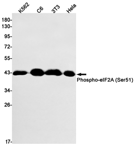 Phospho-eIF2A (Ser51) Rabbit Monoclonal Antibody | 兔单抗 | EnkiLife恩玑生命
