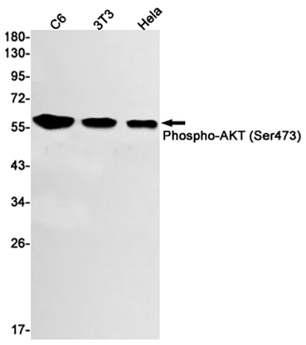 Phospho-AKT (Ser473) Rabbit Monoclonal Antibody | 兔单抗 | EnkiLife恩玑生命