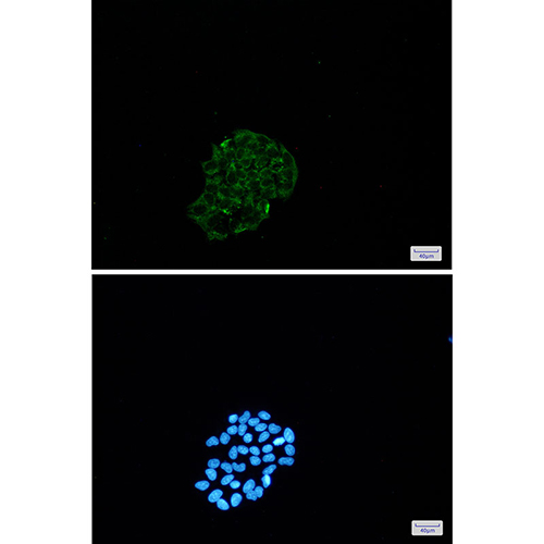BNIP3 Rabbit Monoclonal Antibody | 兔单抗 | EnkiLife恩玑生命