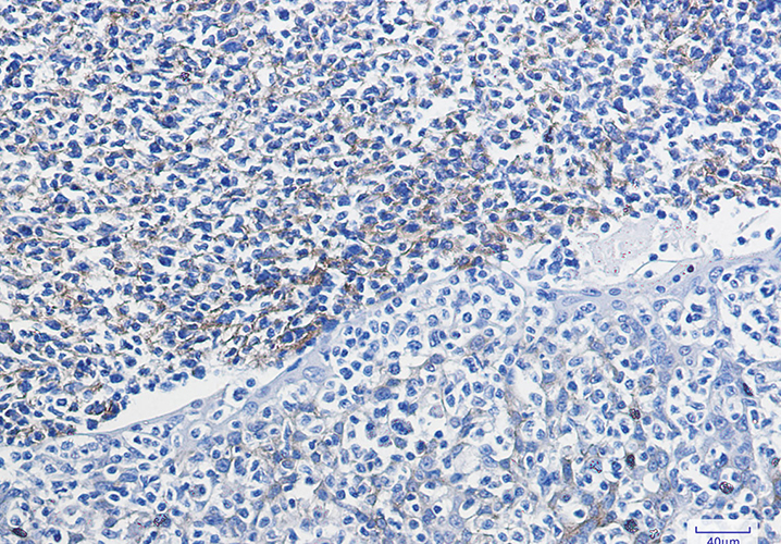 VCAM1 Rabbit Monoclonal Antibody | 兔单抗 | EnkiLife恩玑生命