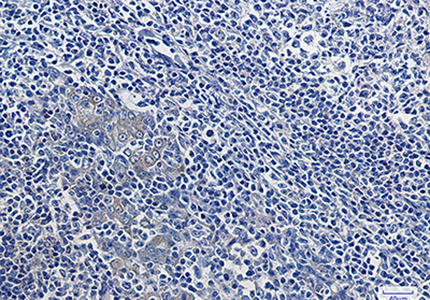 IKB alpha Rabbit Monoclonal Antibody | 兔单抗 | EnkiLife恩玑生命