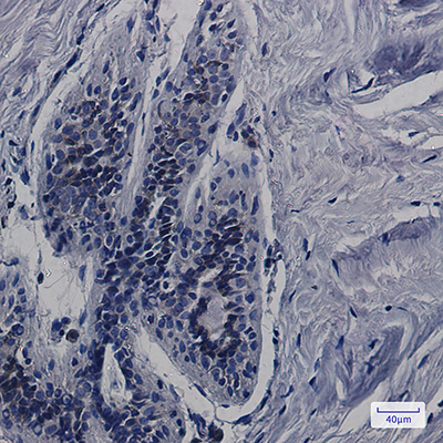 CDK5RAP3 Rabbit Monoclonal Antibody | 兔单抗 | EnkiLife恩玑生命