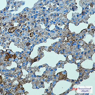 Toll-Like Receptor 2 Rabbit Monoclonal Antibody | 兔单抗 | EnkiLife恩玑生命