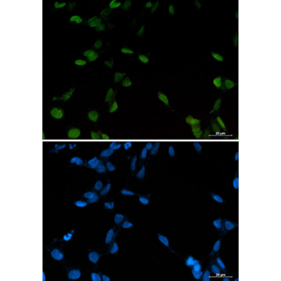 c-Jun Rabbit Monoclonal Antibody | 兔单抗 | EnkiLife恩玑生命