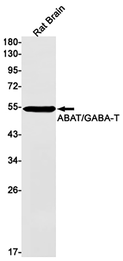 ABAT Rabbit Monoclonal Antibody | 兔单抗 | EnkiLife恩玑生命