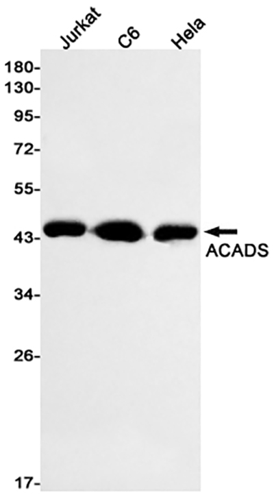 ACADS Rabbit Monoclonal Antibody | 兔单抗 | EnkiLife恩玑生命