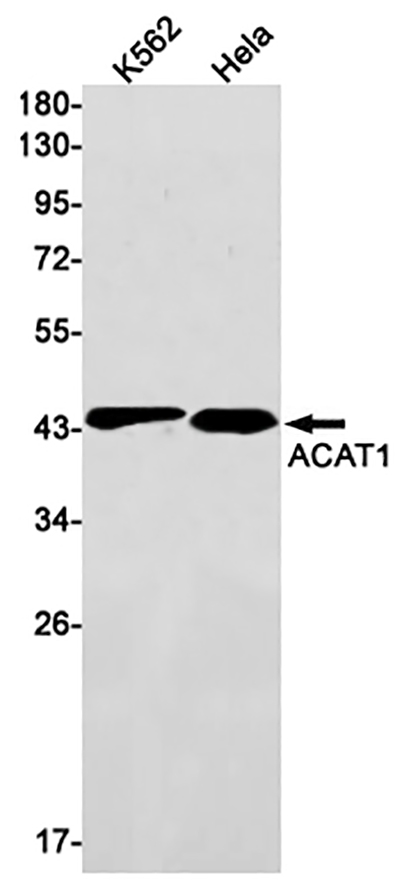 ACAT1 Rabbit Monoclonal Antibody | 兔单抗 | EnkiLife恩玑生命
