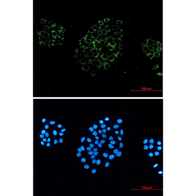 ACOX1 Rabbit Monoclonal Antibody | 兔单抗 | EnkiLife恩玑生命