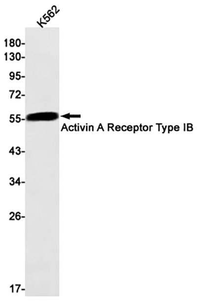 Activin A Receptor Type IB Rabbit Monoclonal Antibody | 兔单抗 | EnkiLife恩玑生命