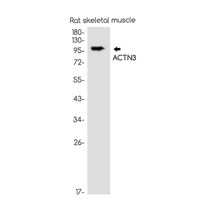ACTN3 Rabbit Monoclonal Antibody | 兔单抗 | EnkiLife恩玑生命