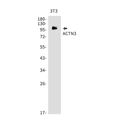 ACTN3 Rabbit Monoclonal Antibody | 兔单抗 | EnkiLife恩玑生命