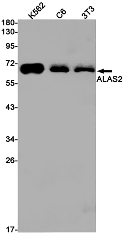 ALAS2 Rabbit Monoclonal Antibody | 兔单抗 | EnkiLife恩玑生命