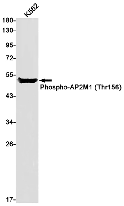 Phospho-AP2M1 (Thr156) Rabbit Monoclonal Antibody | 兔单抗 | EnkiLife恩玑生命