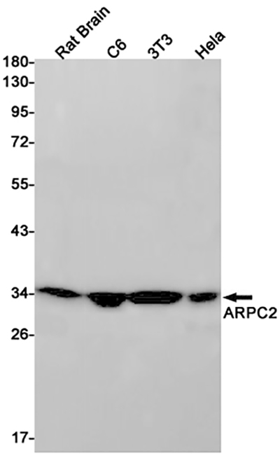 ARPC2 Rabbit Monoclonal Antibody | 兔单抗 | EnkiLife恩玑生命