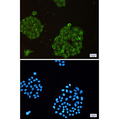 ARPC2 Rabbit Monoclonal Antibody | 兔单抗 | EnkiLife恩玑生命