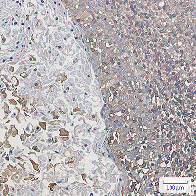 ARPC2 Rabbit Monoclonal Antibody | 兔单抗 | EnkiLife恩玑生命