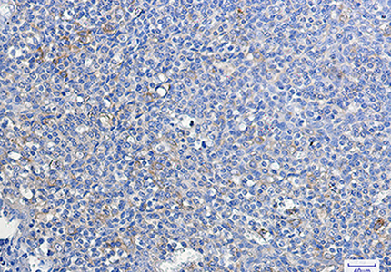 ATG3 Rabbit Monoclonal Antibody | 兔单抗 | EnkiLife恩玑生命