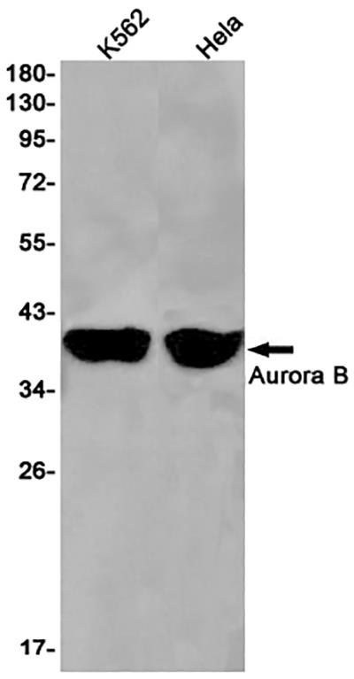 Aurora B Rabbit Monoclonal Antibody | 兔单抗 | EnkiLife恩玑生命