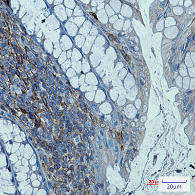 beta 2 Microglobulin Rabbit Monoclonal Antibody | 兔单抗 | EnkiLife恩玑生命