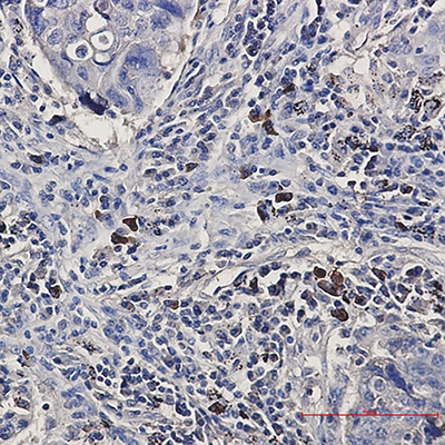 BNIP3L Rabbit Monoclonal Antibody | 兔单抗 | EnkiLife恩玑生命