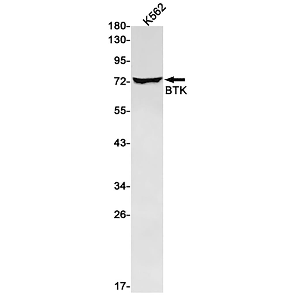BTK Rabbit Monoclonal Antibody | 兔单抗 | EnkiLife恩玑生命