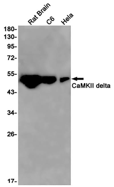 CaMKII delta Rabbit Monoclonal Antibody | 兔单抗 | EnkiLife恩玑生命