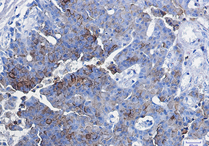 CD63 Rabbit Monoclonal Antibody | 兔单抗 | EnkiLife恩玑生命