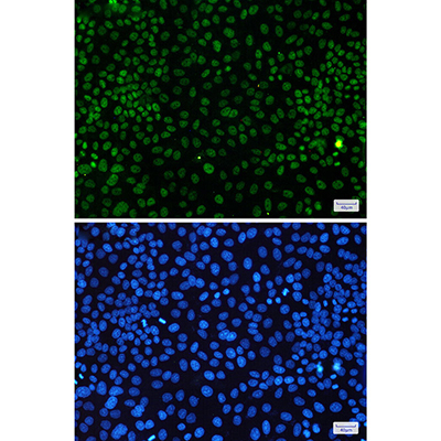 CDK9 Rabbit Monoclonal Antibody | 兔单抗 | EnkiLife恩玑生命