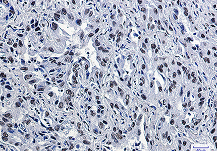 CDK9 Rabbit Monoclonal Antibody | 兔单抗 | EnkiLife恩玑生命