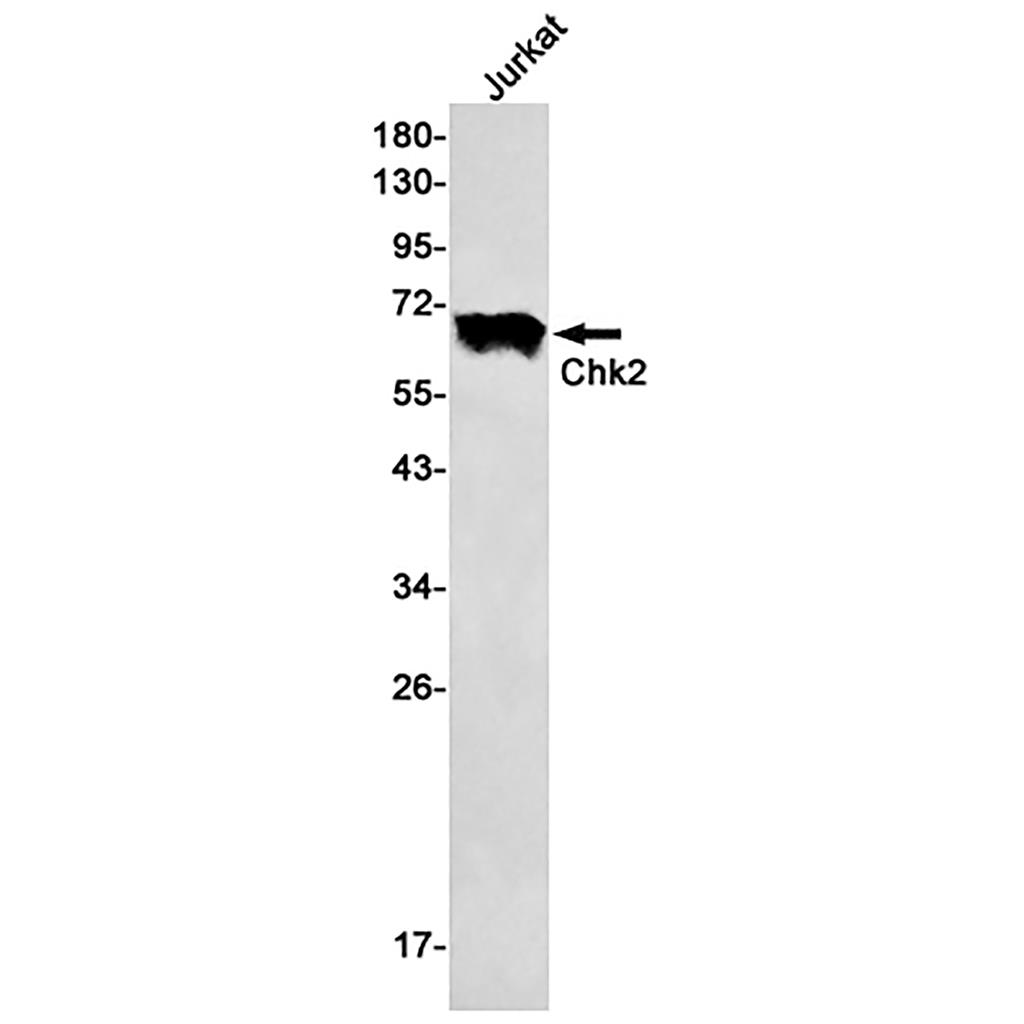Chk2 Rabbit Monoclonal Antibody | 兔单抗 | EnkiLife恩玑生命